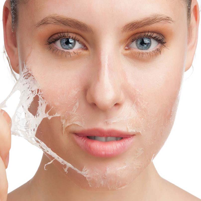Peeling
