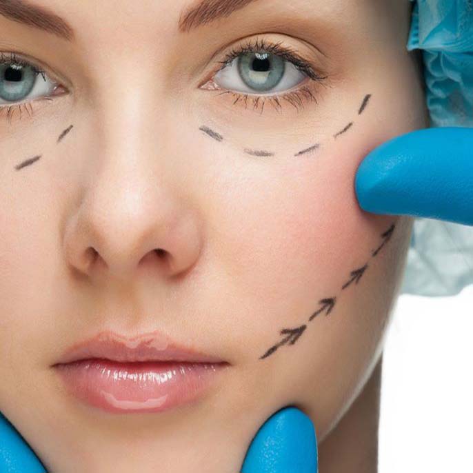 Botox