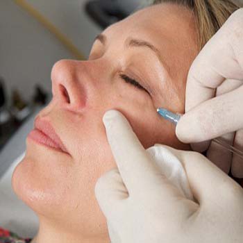 Carboxiterapia